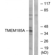 Western blot analysis of extracts from K562 cells, using TMEM185A antibody.