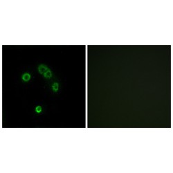 Taste 2 Receptor Member 13 (TAS2R13) Antibody