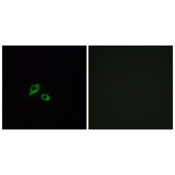 Gastric Inhibitory Polypeptide Receptor (GIPR) Antibody