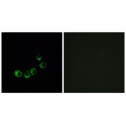 Immunofluorescence analysis of MCF-7 cells, using OR10A5 antibody.