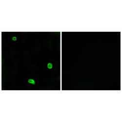 Proteinase-Activated Receptor 4 (F2RL3) Antibody