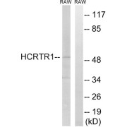 abx015529