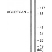 Western blot analysis of extracts from Jurkat cells, treated with Etoposide (25uM, 60mins), using Aggrecan (Cleaved-Asp369) antibody (abx015530).