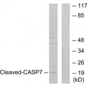 Western blot analysis of extracts from 293 cells, treated with Etoposide (25uM, 60mins), using Caspase 7 (cleaved-Asp198) antibody.