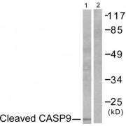 Western blot analysis of extracts from NIH/3T3 cells, treated with Etoposide (25 µM, 60 mins), using Caspase 9 (cleaved-Asp353) antibody. The lane on the right is blocked with the synthesized peptide.