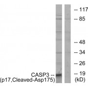 Western blot analysis of extracts from COLO cells, using CASP3 (p17, Cleaved-Asp175) antibody.