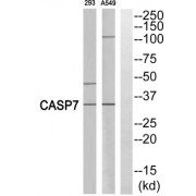 Western blot analysis of extracts from 293 cells and A549 cells, using Caspase 7 (p11, Cleaved-Ala207) antibody.
