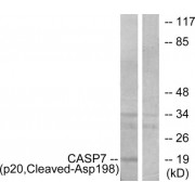 Western blot analysis of extracts from Jurkat cells, treated with etoposide (25uM, 24hours), using CASP7 (p20, Cleaved-Asp198) antibody.