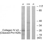 Western blot analysis of extracts from Jurkat cells treated with etoposide (25uM, 24hours) and COS-7 cells treated with etoposide (25uM, 1hour), using COL4A3 (Cleaved-Pro1426) antibody.