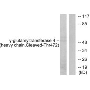 Western blot analysis of extracts from Jurkat cells, treated with etoposide (25uM, 24hours), using Gamma-glutamyltransferase 4 (heavy chain, Cleaved-Thr472) antibody.
