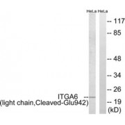 Western blot analysis of extracts from HeLa cells treated with etoposide (25uM, 24hours), using ITGA6 (light chain, Cleaved-Glu942) antibody.