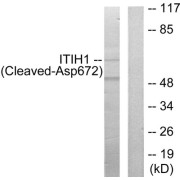 Western blot analysis of extracts from Jurkat cells, treated with etoposide (25uM, 24hours), using ITIH1 (Cleaved-Asp672) antibody.