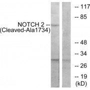 Western blot analysis of extracts from Jurkat cells, treated with etoposide (25uM, 24hours), using NOTCH2 (Cleaved-Ala1734) antibody.