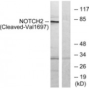 Western blot analysis of extracts from Jurkat cells, treated with etoposide (25 µM, 24 hours), using NOTCH2 (Cleaved-Val1697) antibody. The lane on the right is blocked with the synthesized peptide.