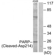 Western blot analysis of extracts from A549 cells, treated with etoposide (25uM, 24hours), using PARP (Cleaved-Asp214) antibody.