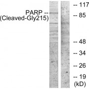 Western blot analysis of extracts from 3T3 cells, treated with etoposide (25uM, 1hour), using PARP (Cleaved-Gly215) antibody.