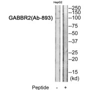 WB analysis of HepG2 cell extracts, using Gamma-Aminobutyric Acid Type B Receptor Subunit 2 (GABBR2) Antibody. The lane on the right was blocked with the corresponding peptide.