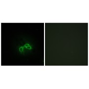 Immunofluorescence analysis of NIH/3T3 cells, using BLCAP Antibody. The picture on the right is blocked with the synthesized peptide.