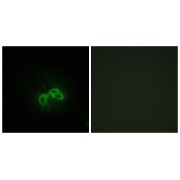 Immunofluorescence analysis of NIH/3T3 cells, using BLCAP Antibody. The picture on the right is blocked with the synthesized peptide.