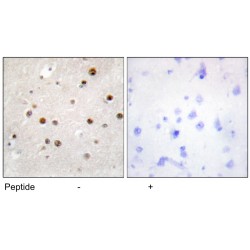 Translin (TSN) Antibody
