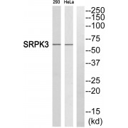 Western blot analysis of extracts from 293 cells and HeLa cells, using SRPK3 antibody. The lane on the right is blocked with the synthesised peptide.