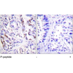 M-Phase Inducer Phosphatase 1 Phospho-Ser76 (CDC25A pS76) Antibody