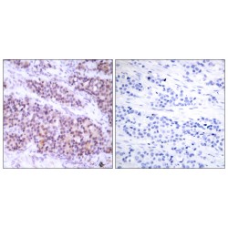 Apoptosis Regulator Bcl-X Phospho-Ser62 (BCL-XL pS62) Antibody