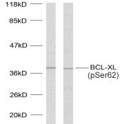 Western blot analysis of lysates from 293 cells treated with UV and MDA-MB-435 cells treated with UV, using BCL-XL (pS62) Antibody.