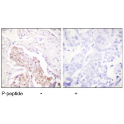 Fanconi Anemia Complementation Group D2 Phospho-Ser222 (FANCD2 pS222) Antibody