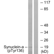 Western blot analysis of lysates from mouse brain cells, using Synuclein-alpha (Phospho-Tyr136) Antibody. The lane on the right is blocked with the phosphopeptide.