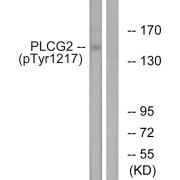 Western blot analysis of extracts from Jurkat cells, treated with UV (15 mins), using PLCG2 (Phospho-Tyr1217) antibody. The lane on the right is blocked with the phosphopeptide.