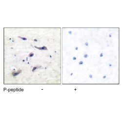 mTOR (pS2448) Antibody