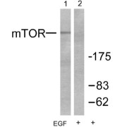 Western blot analysis of extracts from Hela cells treated with EGF (200 ng/ml, 30mins), using mTOR (pS2448) (Line 1 and 2).