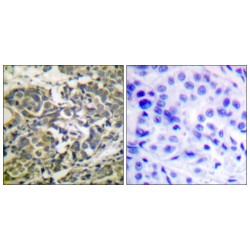 5'-AMP-Activated Protein Kinase Catalytic Subunit Alpha-1 Phospho-Thr172 (PRKAA1 pT172) Antibody