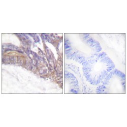 Linker For Activation Of T-Cell Phospho-Tyr191 (LAT pY191) Antibody