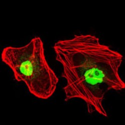 Replication Protein A 70 kDa DNA-Binding Subunit (RPA1) Antibody