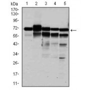Western blot analysis using RPA1 antibody against human RPA1 (AA: 308-513) recombinant protein. (Expected MW is 48.3 kDa).