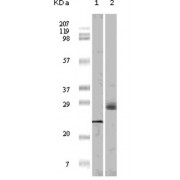 Western blot analysis using 4E-BP1 antibody against truncated 4E-BP1 recombinant protein (1) and A431 cell lysate (2).