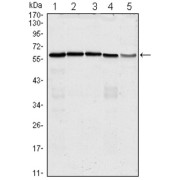 Western blot analysis using anti-CDC25C antibody against Hela (1), K562 (2), PC-3 (3), HEK293 (4) and Raw264.7 (5) cell lysate.