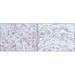 P21 Protein Activated Kinase 2 (PAK2) Antibody