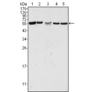 Western blot analysis using PAK2 antibody against Hela (1), Jurkat (2), A549 (3), HEK293 (4) and K562 (5) cell lysate.