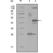 Western blot analysis using MAP4K4 antibody against truncated Trx-MAP4K4 recombinant protein (1), MBP-MAP4K4 (aa300-400) recombinant protein (2) and MAP4K4 (aa194-436) -hIgGFc transfected CH0-K1 cell lysate (3).