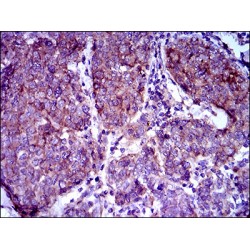 ATP-Binding Cassette Subfamily B Member 5 (ABCB5) Antibody