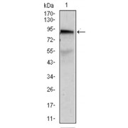 Western blot analysis using ABCB5 antibody against human ABCB5 recombinant protein. (Expected MW is 47 kDa).