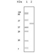 Western blot analysis using ABL2 antibody against truncated ABL2 recombinant protein.