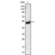 Western blot analysis using AGT antibody against human plasma (1).