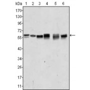Western blot analysis using AKT2 antibody against A431 (1), Jurkat (2), HEK293 (3), A549 (4), MCF-7 (5) and PC-12 (6) cell lysate.