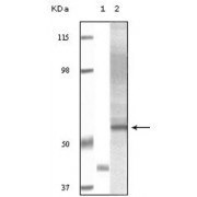 Western blot analysis using Akt3 antibody against truncated Akt3 recombinant protein (1) and human ovary carcinoma tissue lysate (2).