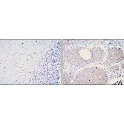 Retinal Dehydrogenase 1 (ALDH1A1) Antibody