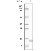 Western blot analysis using SNCA antibody against truncated SNCA recombinant protein.